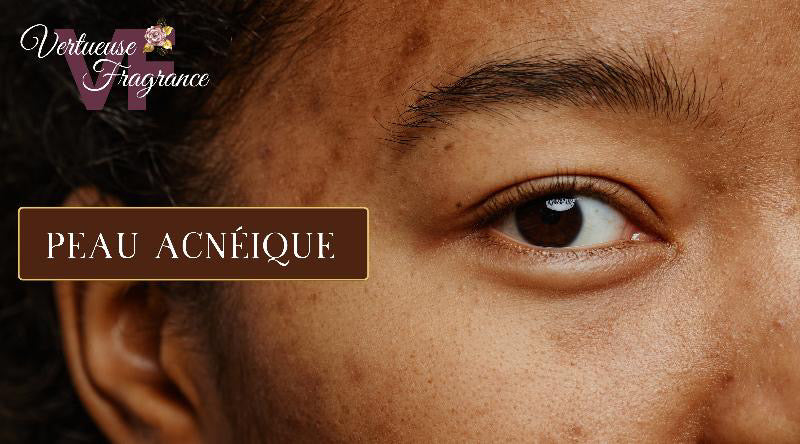 peau acnéique