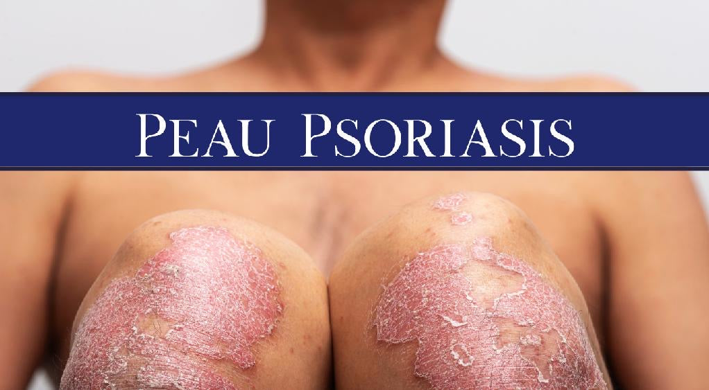 peau psoriasis